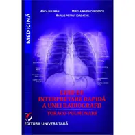 Ghid de interpretare rapida a unei radiografii toraco-pulmonare